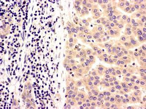 亿万先生mr·(中国区)官方网站