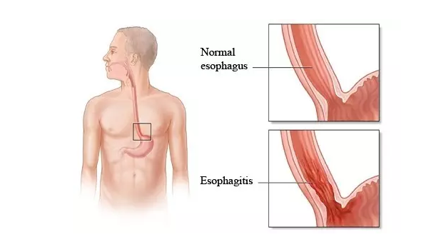 亿万先生mr·(中国区)官方网站