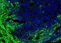 联协实力！溶瘤病毒与CAR-T翻开攻克实体瘤难题的新思绪