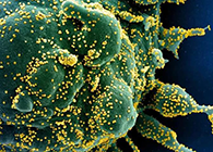 唾液检测新冠抗体新要领来了，，，，，，获取效果仅需几小时！