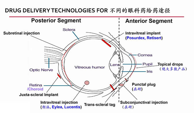 【内附回放+下半场预约】亿万先生mr眼科药物专题钻研会上半场精彩回首