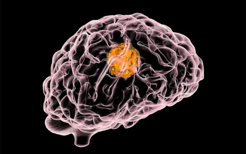 亿万先生mr助力 | 璧辰医药ABM-1310获美国FDA孤儿药资格认证，，，，，，，，用于治疗携带BRAF V600突变的脑胶质母细胞瘤患者